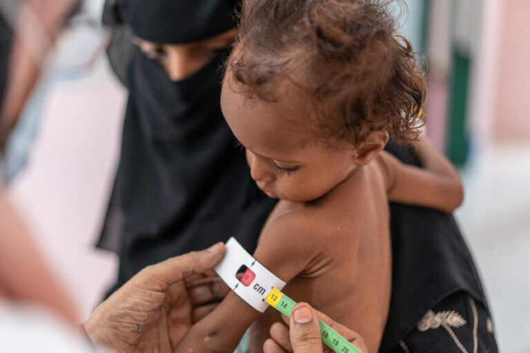 Hambre extrema amenaza a más de 295 millones de personas en el mundo