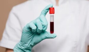 transfusiones sanguíneas