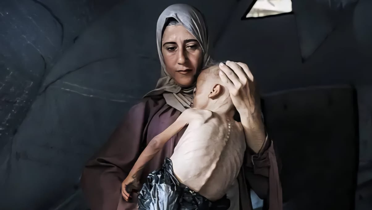 El hambre como arma genocida en Gaza
