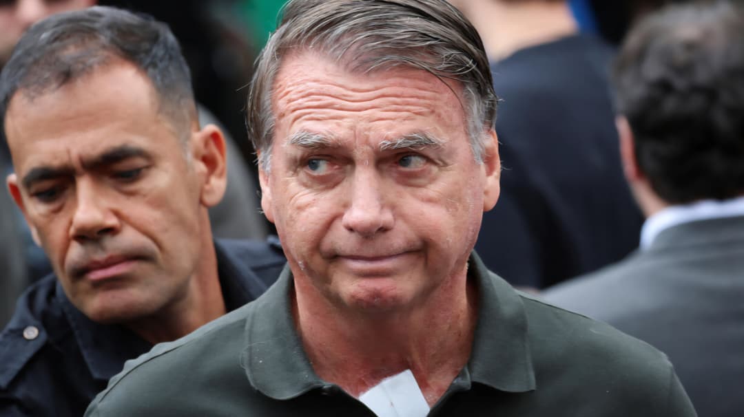 Revelan diagnóstico de salud de Jair Bolsonaro