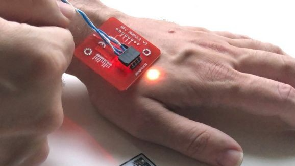 Se metió un microchip en el cuerpo y se olvidó la clave