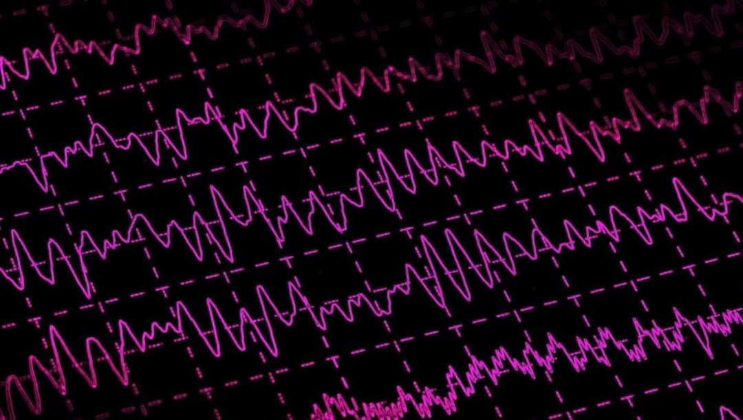 El ruido rosa: un riesgo para la salud del sueño según un nuevo estudio