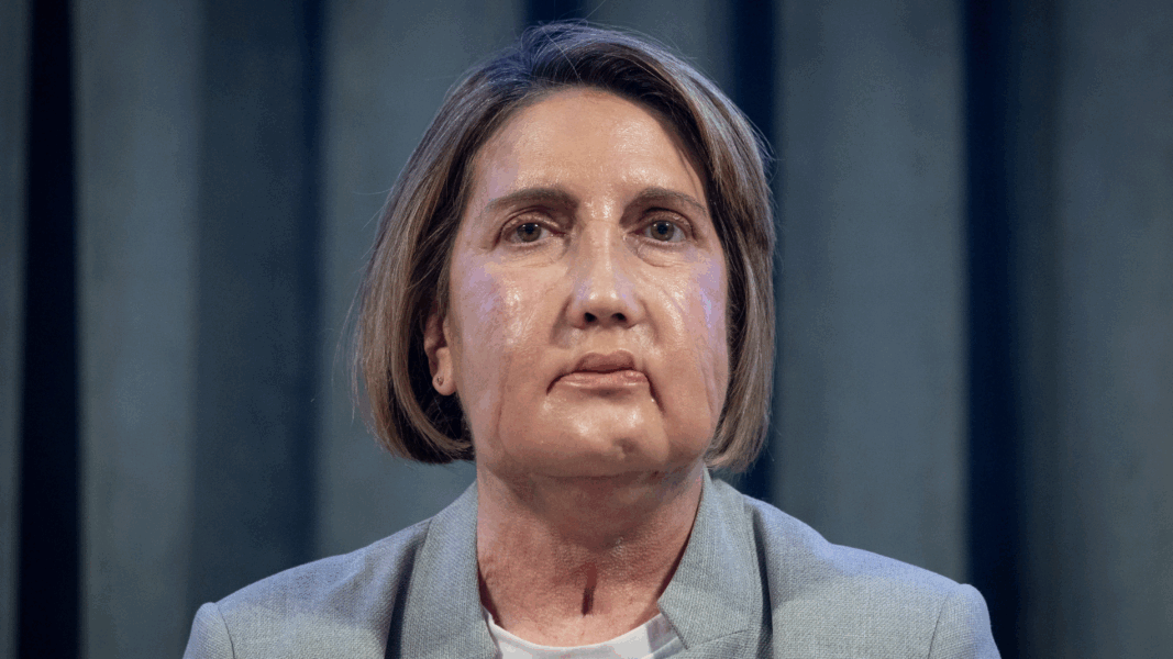 España lidera un hito médico mundial al completar un trasplante facial